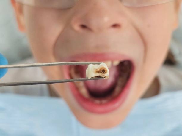 Best Orthodontic Emergency Dentist in Elmore, AL